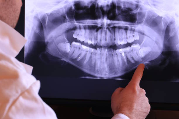 Best Emergency Root Canal Treatment in Kempner, TX