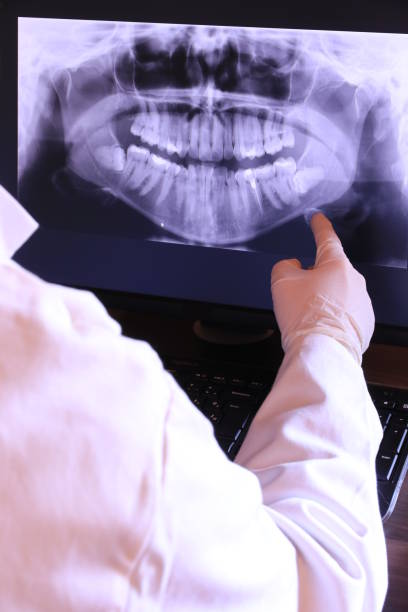 Best Emergency Root Canal Treatment in Kempner, TX
